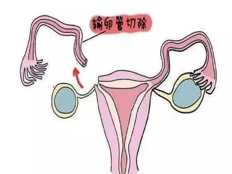 济南能供卵的医院,北京供卵助孕