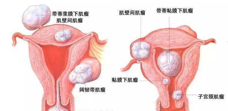北京哪个医院做试管婴儿的妊娠率高呢？北京协和医院供卵试管多少钱？