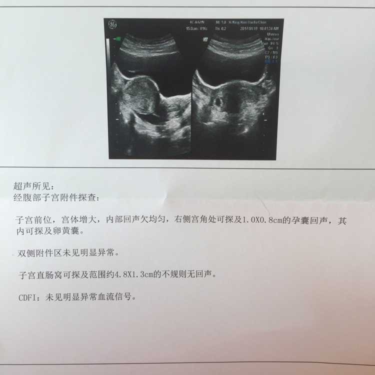 北京供卵等多久-北京大学第三医院供卵吗？